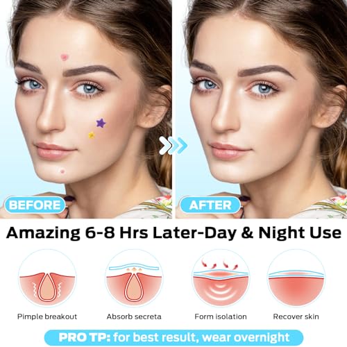 VOZRO Cute Pimple Patches - 271 Count Colorful Hydrocolloid Acne Stickers with Salicylic Acid & Tea Tree Oil