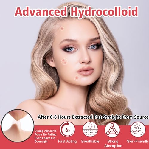 YHOVID Hydrocolloid Pimple Patches - 450 Invisible Acne Zit Stickers