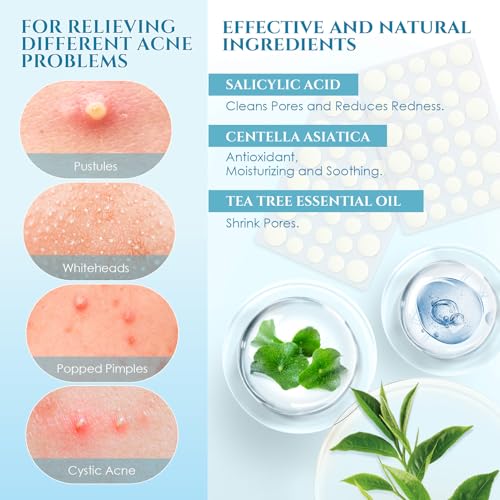 PITHER Hydrocolloid Pimple Patches - 288 Count Acne Zit Stickers