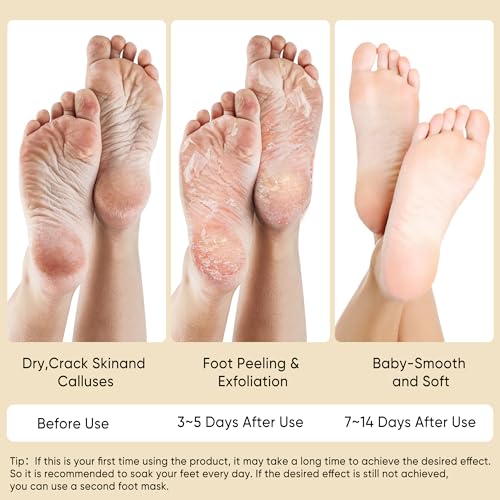 Coconut Foot Peeling Mask 3 Pairs - Exfoliating Dead Skin Remover for Dry Feet and Cracked Heels