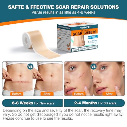 Vakimou Silicone Scar Tape Roll for Surgical, C-Section & Keloid Scars