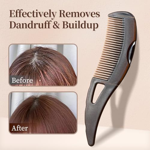 Optisake Creative Dandruff Comb with Press Button and Ergonomic Handle