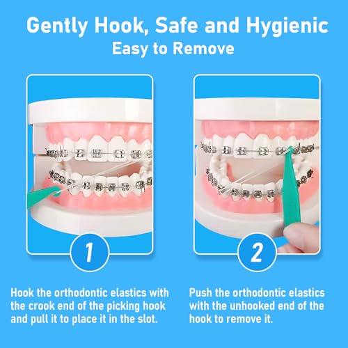 YYING Orthodontic Rubber Bands 3/16 Heavy 6.5 oz 100 Pcs Dental Elastics