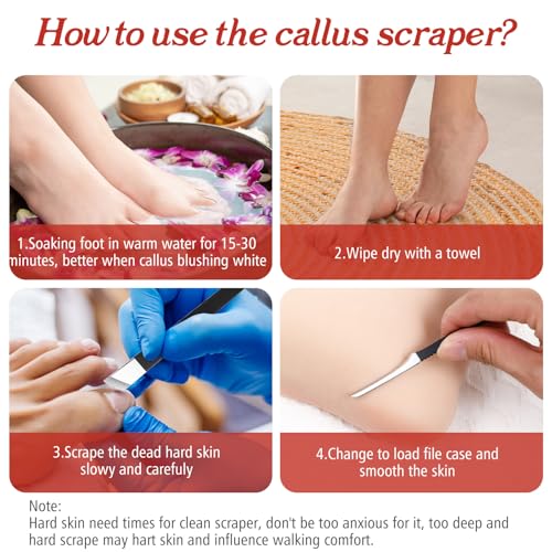 JJUNW 6-Piece Professional Pedicure Knife Set & Foot Callus Remover with Storage Box