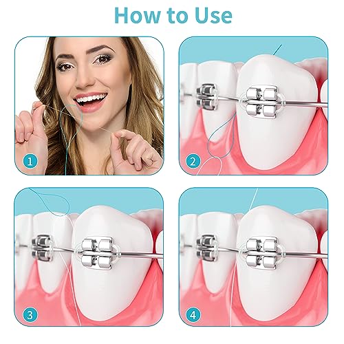 Dental Floss Threader for Braces, Bridges and Implants, 200 Count
