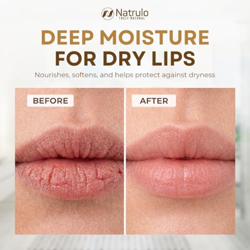Natrulo Coconut Lip Balm – Moisturizing Beeswax Chapstick for Dry Cracked Lips