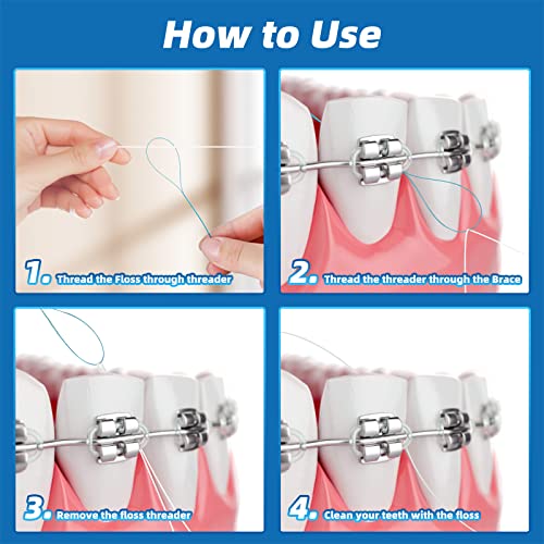 Kuvvfe Floss Threaders for Braces, Bridges and Implants 200 Count