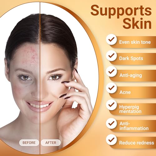 Twins Personal Care Egg Soap with Kojic & Hyaluronic Acid