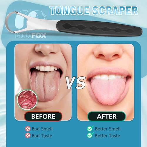Milifox Stainless Steel Tongue Scraper with Case - Black