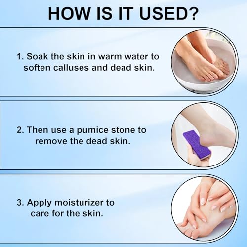 Foot Pumice Stone 2-Pack Callus Remover & Scrubber for Feet, Purple