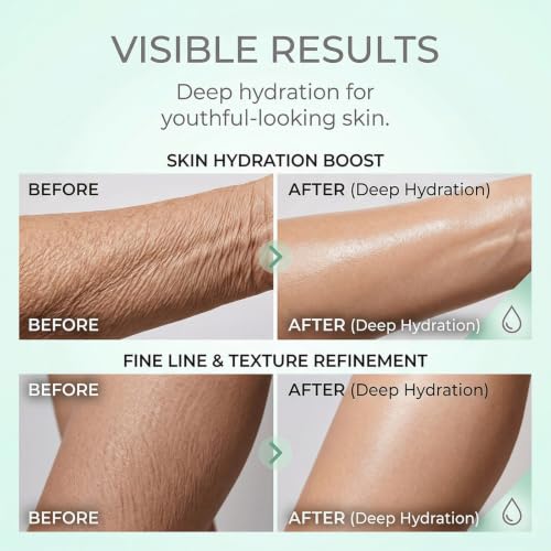 Fhjkuy Retinol Body Lotion - Firming & Moisturizing Cream for Neck and Body