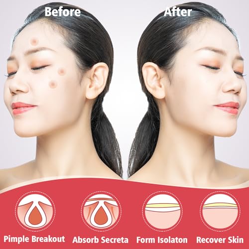 YHOVID Hydrocolloid Pimple Patches - 450 Invisible Acne Zit Stickers