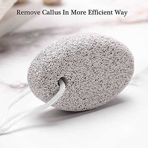 HOOMBOOM Natural Pumice Stone for Feet (2-Pack) - Hard Skin and Callus Remover