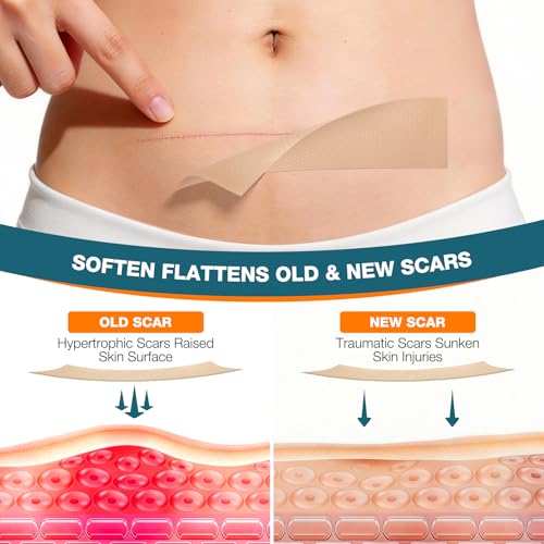 Vakimou Silicone Scar Tape Roll for Surgical, C-Section & Keloid Scars