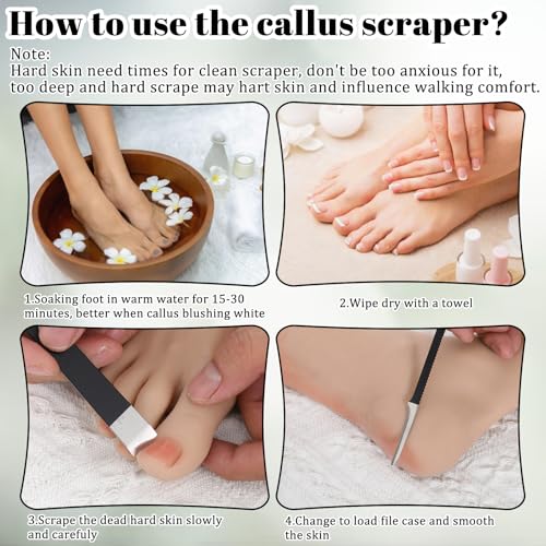 Gtziqa 6-Piece Stainless Steel Ingrown Toenail Removal Kit & Pedicure Tool Set