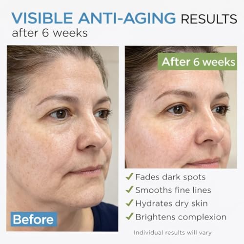 Joliezza Collagen Retinol Face Cream with Hyaluronic Acid & Vitamin C