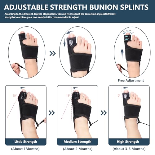 2 Pack Bunion Corrector for Women & Men, Orthopedic Bunion Splint for Hallux Valgus Pain Relief, Big Toe Separator, Adjustable Day/Night Support, Comfortable Hammer Toe Straightener