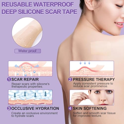 Mitgary Silicone Scar Sheets - Medical Grade Tape for C-Sections & Surgeries