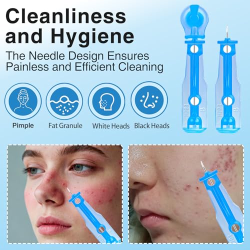 Xiuouix 60PCS Pimple Popper Kit with 72 Acne Patches, Blue