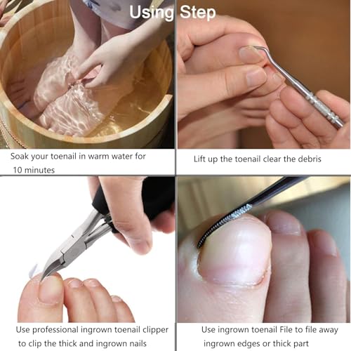 Ingrown Toenail File and Lifter Tool Kit - Stainless Steel Pedicure Set
