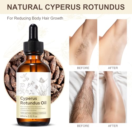 Nifeishi Cyperus Rotundus Hair Removal Oil 60ml