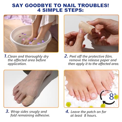 Ruduwu Extra Strength Toenail Treatment Patches - 32 Overnight Nail Repair Strips
