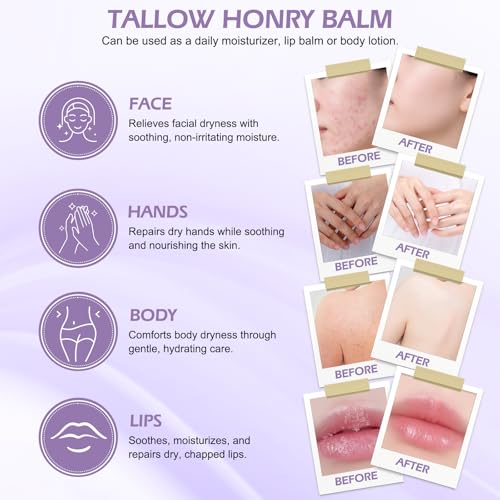 ADOVA Tallow Honey Balm Moisturizer for Face & Body, 2 Pack
