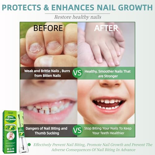 Soralis Nail Biting Treatment & Thumb Sucking Deterrent - 2-in-1 Polish