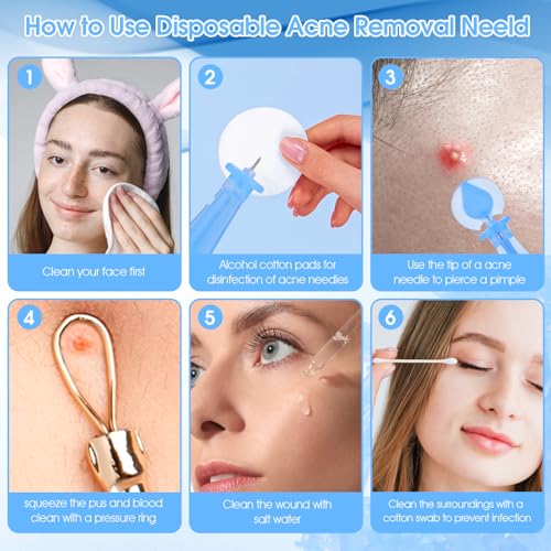 AOZUO 100PCS Sterile Pimple Needles Disposable Blackhead Remover Tool