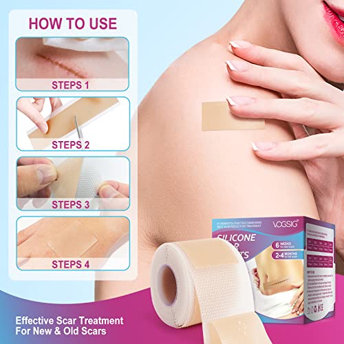 Silicone Scar Tape Roll, 1.6" x 75" Medical Grade Scar Sheets for Old and New Scars