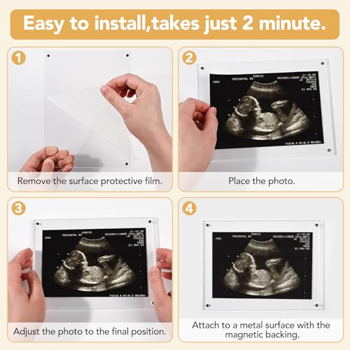 6x8 Magnetic Acrylic Ultrasound Picture Frame - Rectangle Sonogram Keepsake