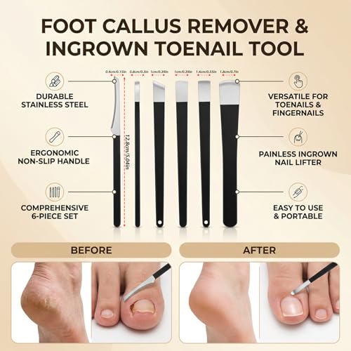 8-Piece Ingrown Toenail Removal Kit & Corrector Tool with Storage Box