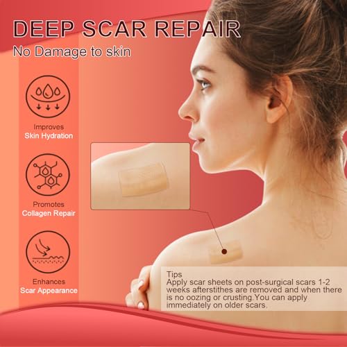 Tearich Silicone Scar Sheets - Medical Grade Scar Tape Roll for C-Section, Surgery & Burns