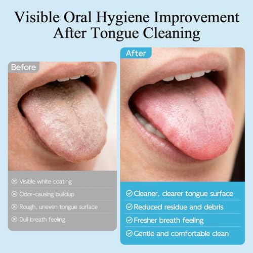 Monnzell Silicone Tongue Scraper and Brush for Bad Breath