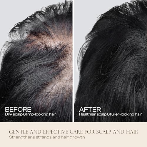 Jtopyrt Rosemary Castor Hair Growth Oil - 50ml Scalp Care Treatment