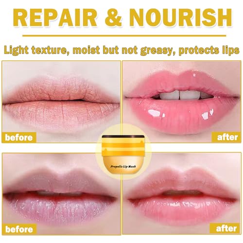 Bee Lip Balm Honey Pot Set - 2PCS Hydrating Overnight Lip Mask