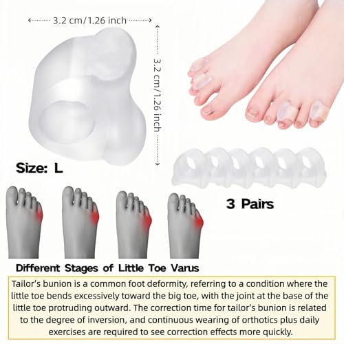 Gel Toe Separators 6 Pack - Soft Silicone Spacers for Bunion Relief