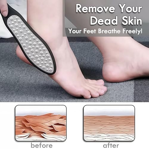 3-in-1 Large Stainless Steel Foot File & Callus Remover for Cracked Heels