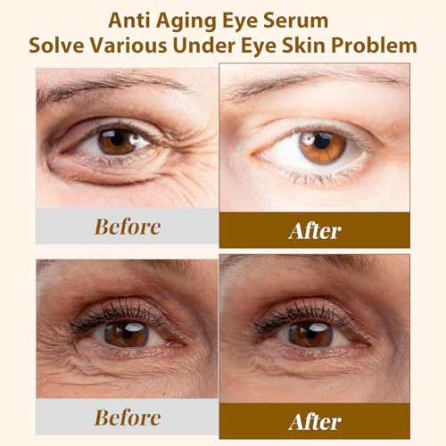 EJW Revive Eye Serum with Retinoid - Hydrating & Anti-Aging Under Eye Treatment, 0.5 oz