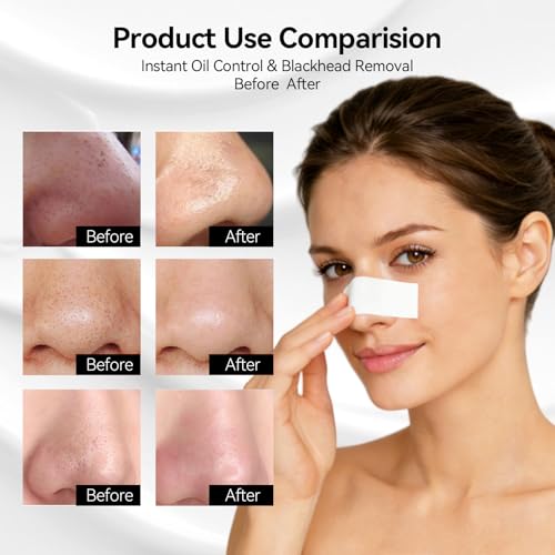 LANBENA Blackhead Removal Mask Strips Paper - 120 Pcs
