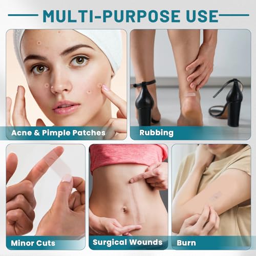 CUKWUYBY Hydrocolloid Pimple Patch Roll - Cut-to-Size Acne Tape