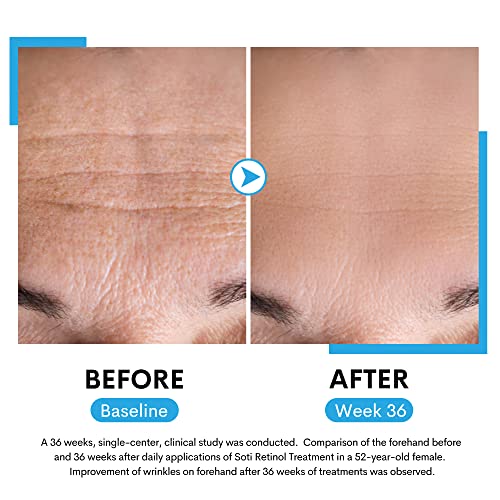 Soti Retinol Face Serum with Hyaluronic Acid & Niacinamide 30ml