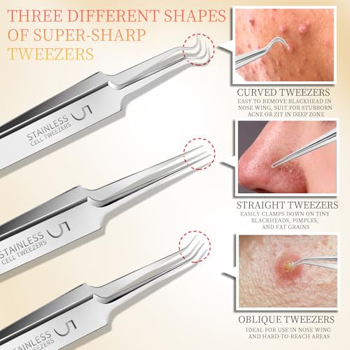 Teenitor 4-Piece Blackhead Remover Tweezers & Pimple Popper Kit