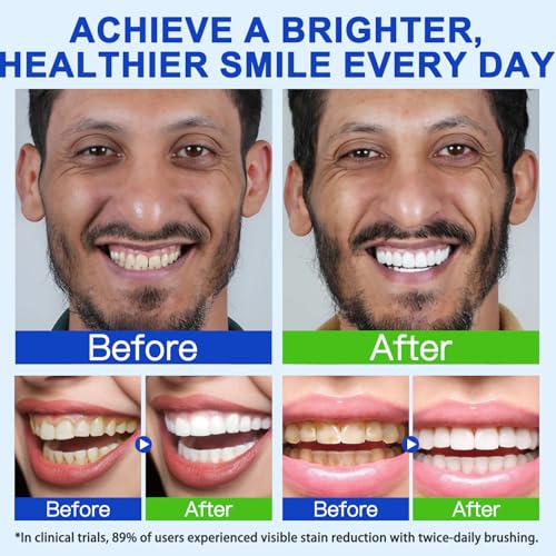 Hydroxyapatite Toothpaste 7.5% - Fluoride-Free Enamel Protection 120g