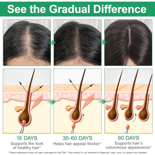 KITNOBLIS Hair Growth Serum Roll-On with Rosemary, Redensyl & AnaGain, 20 ML