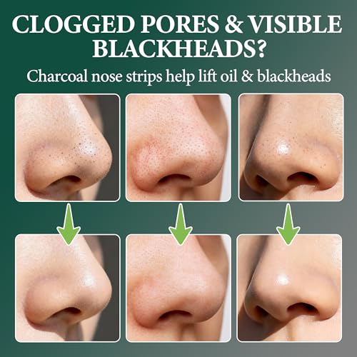 Lubynia Charcoal Blackhead Remover Nose Strips - Deep Cleansing Pore Strips