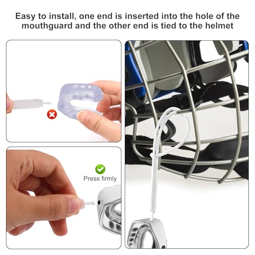 5pcs Rugby Mouth Guard Strap, Football Mouth Piece Tether Only Universal Replacement Strap for Teens Sports Football Rugby Hockey Basketball Boxing for Most Mouthguards Accessories (White)