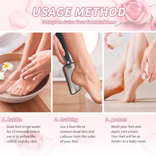 TOPMEET Professional Stainless Steel Foot File & Callus Remover for Dead Skin
