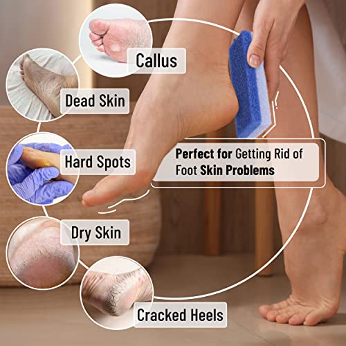 Slick Natural Pumice Stone Foot Callus Remover 4-Pack
