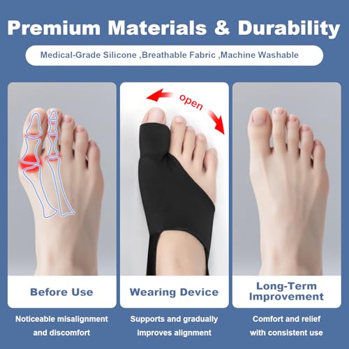 2-Pack Bunion Corrector for Women & Men | Big Toe Straightener Splint with Silicone Spacers | Relieves Hallux Valgus, Bunion Pain & Bursitis | Day & Night Use